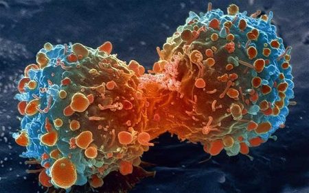 Le cancer frappe-t-il au hasard? cancer