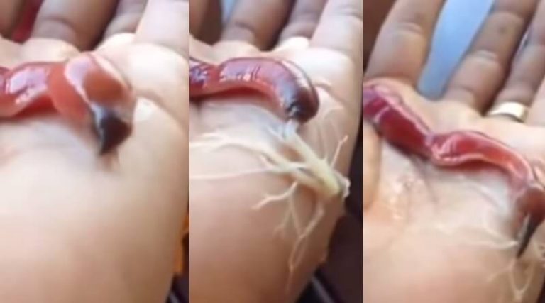 Ce ver effrayant attaque la main d&rsquo;une personne