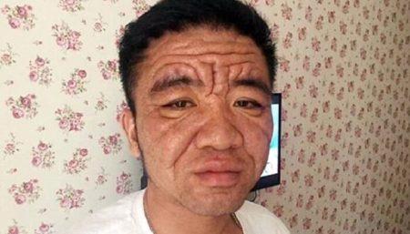 Yuan Taiping, maladie inconnue, Chine