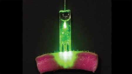 Un laser pour refermer les blessures sans points de suture laser qui referme une blessure