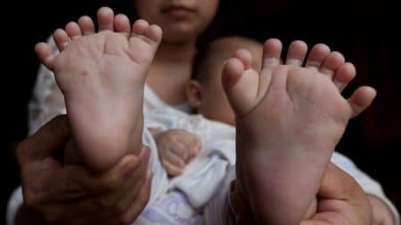 Un bébé chinois naît avec 31 doigts et orteils Bébé chinois avec 31 doigts et orteils