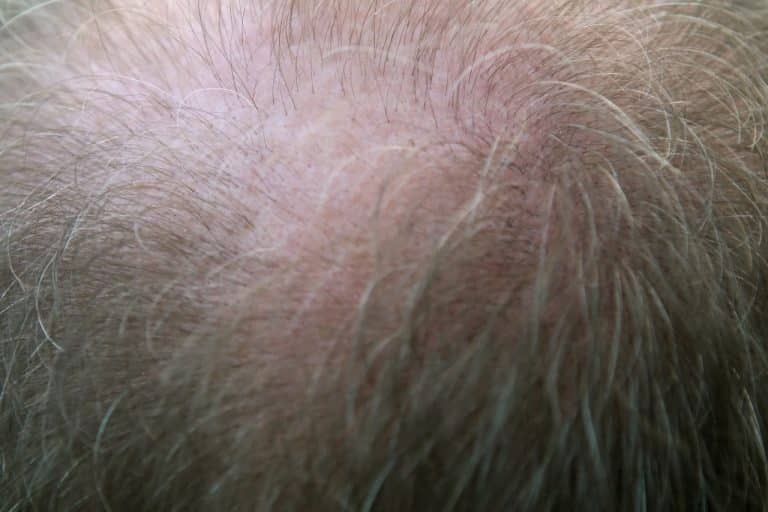 Des scientifiques japonais ont réussi à cultiver des cheveux en laboratoire