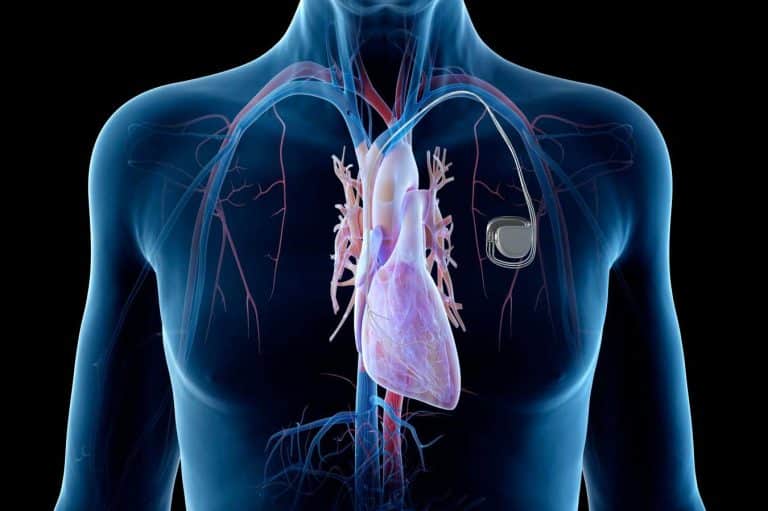 Une révolution dans la technologie médicale : une batterie implantable se recharge grâce à l&rsquo;oxygène de votre corps !