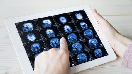 L’IRM la plus puissante au monde dévoile des images cérébrales époustouflantes