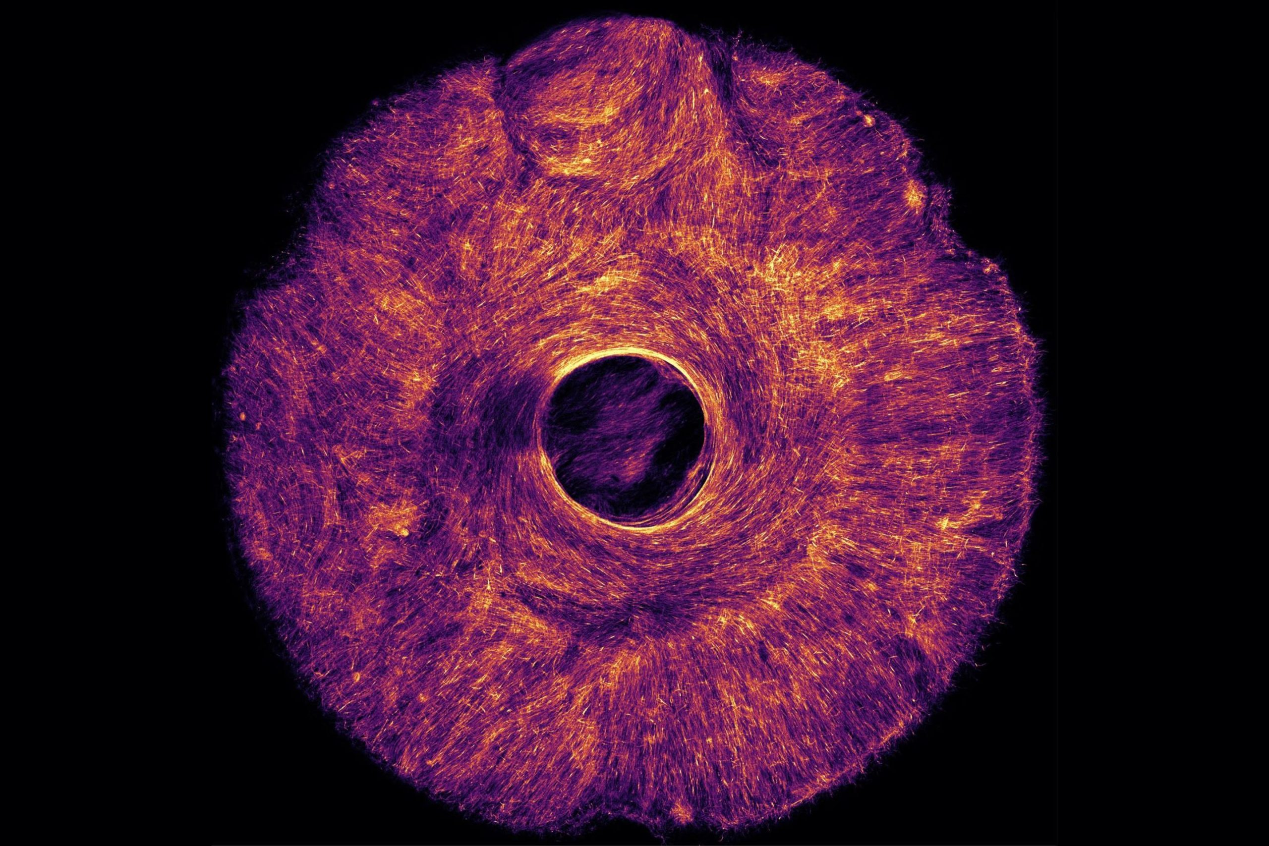 Cette structure artificielle, animée par des muscles, exerce une traction à la fois de façon concentrique et radiale, semblable au fonctionnement de l'iris humain qui dilate et contracte la pupille.
